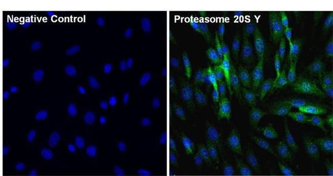 PSMB6 Antibody in Immunocytochemistry (ICC/IF)