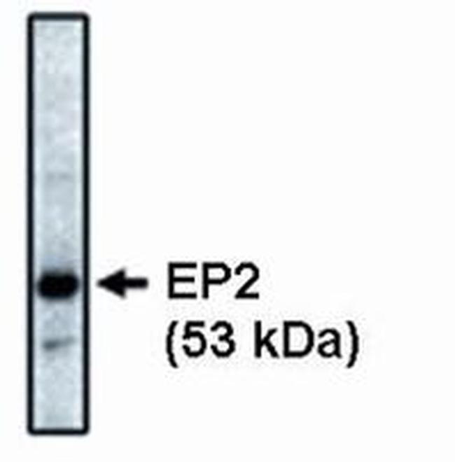 PTGER2 Antibody in Western Blot (WB)