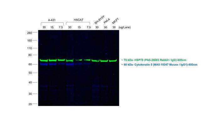 Mouse IgG (H+L) Secondary Antibody in Western Blot (WB)