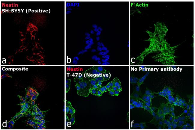 Mouse IgG (H+L) Secondary Antibody in Immunocytochemistry (ICC/IF)