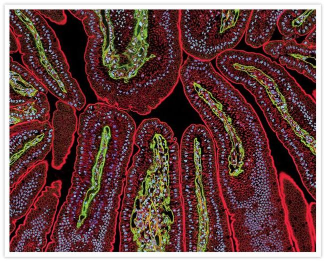 Human IgG (H+L) Secondary Antibody in Immunohistochemistry (IHC)