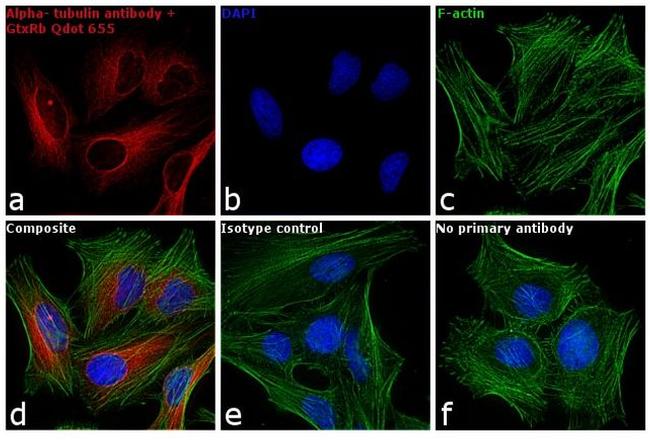 Rabbit IgG (H+L) Secondary Antibody in Immunocytochemistry (ICC/IF)