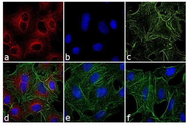 Rat IgG (H+L) Secondary Antibody in Immunocytochemistry (ICC/IF)