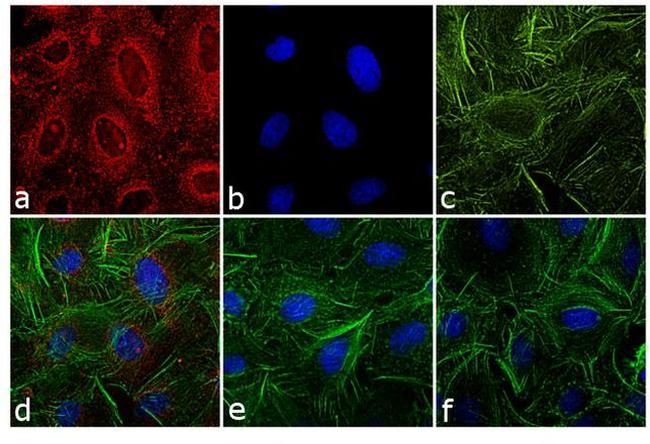 Rat IgG (H+L) Secondary Antibody in Immunocytochemistry (ICC/IF)