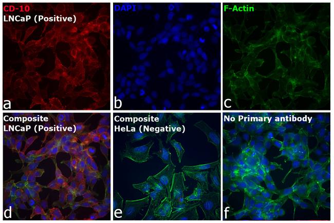 Goat IgG (H+L) Secondary Antibody in Immunocytochemistry (ICC/IF)