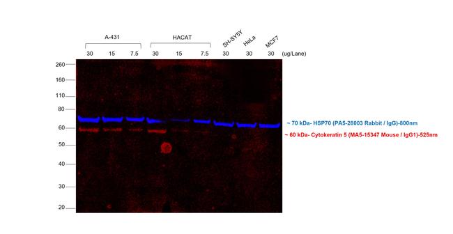 Mouse IgG (H+L) Secondary Antibody in Western Blot (WB)