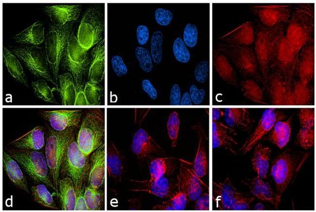 Rabbit IgG (H+L) Secondary Antibody in Immunocytochemistry (ICC/IF)