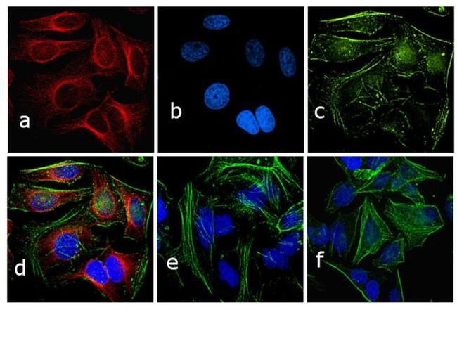 Rabbit IgG (H+L) Secondary Antibody in Immunocytochemistry (ICC/IF)