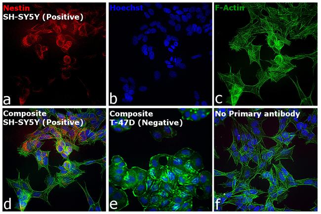 Mouse IgG (H+L) Secondary Antibody in Immunocytochemistry (ICC/IF)