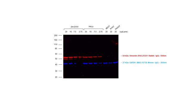 Rabbit IgG (H+L) Cross-Adsorbed Secondary Antibody in Western Blot (WB)