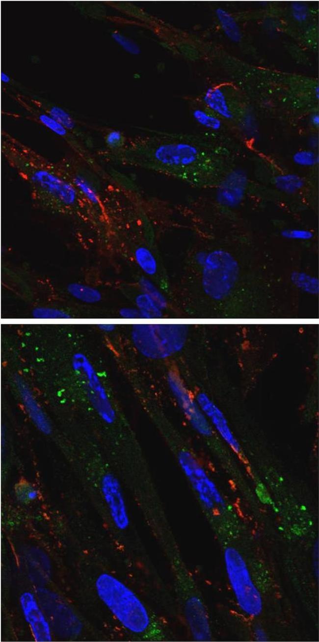 RAB5 Antibody in Immunocytochemistry (ICC/IF)