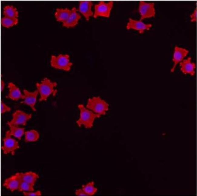 RAB5 Antibody in Immunocytochemistry (ICC/IF)