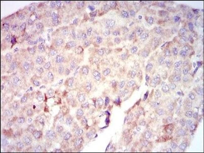 c-Raf Antibody in Immunohistochemistry (Paraffin) (IHC (P))