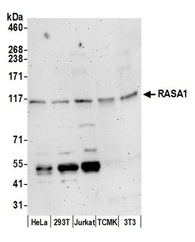 RASA1 Antibody in Western Blot (WB)