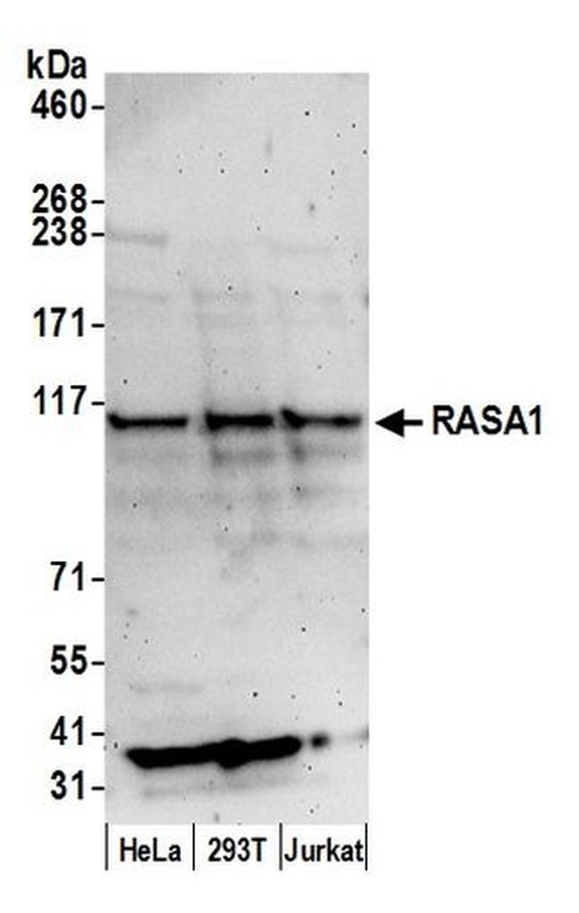 RASA1 Antibody in Western Blot (WB)