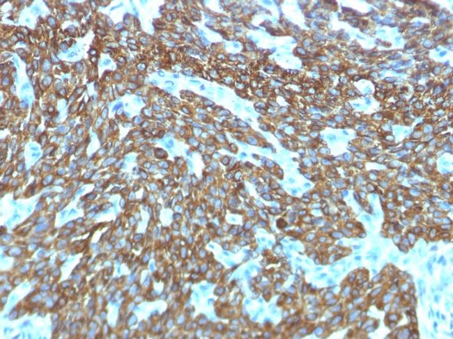 Cytokeratin, Basic (Type II or HMW) Antibody in Immunohistochemistry (Paraffin) (IHC (P))