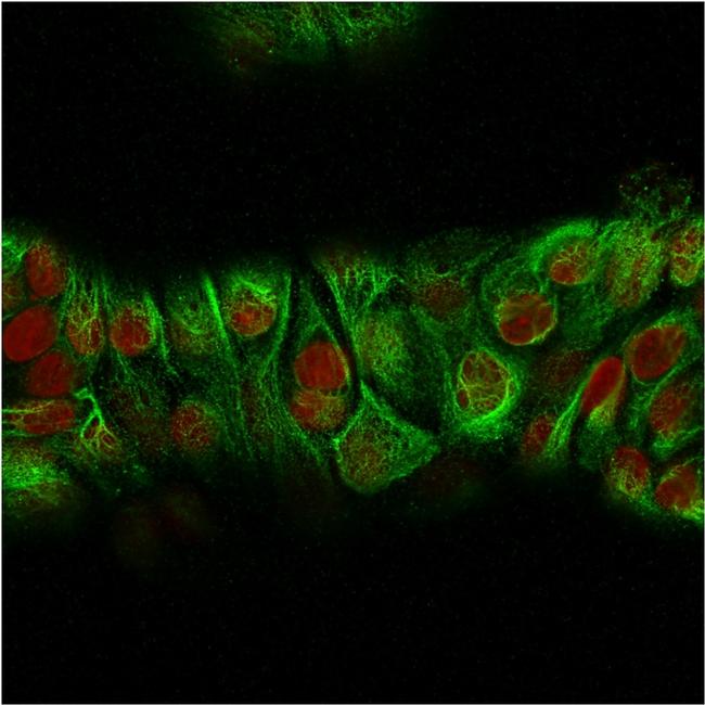 Cytokeratin, Basic (Type II or HMW) Antibody in Immunocytochemistry (ICC/IF)