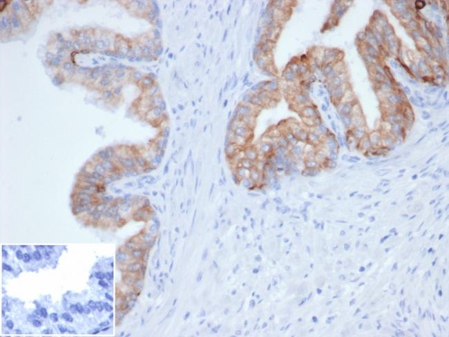 Cytokeratin, pan (Epithelial Marker) Antibody in Immunohistochemistry (Paraffin) (IHC (P))