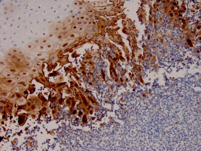 HSV1 (Herpes Simplex Virus Type I) Antibody in Immunohistochemistry (Paraffin) (IHC (P))