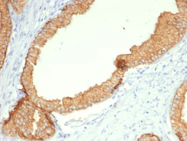 Cytokeratin, Type II (Epithelial Marker) Antibody in Immunohistochemistry (Paraffin) (IHC (P))