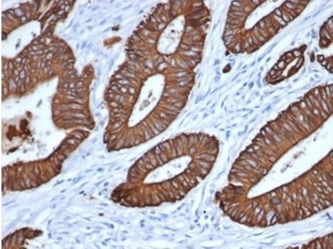 Cytokeratin, pan (Epithelial Marker) Antibody in Immunohistochemistry (Paraffin) (IHC (P))