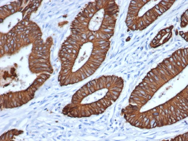 Cytokeratin, pan Antibody in Immunohistochemistry (Paraffin) (IHC (P))