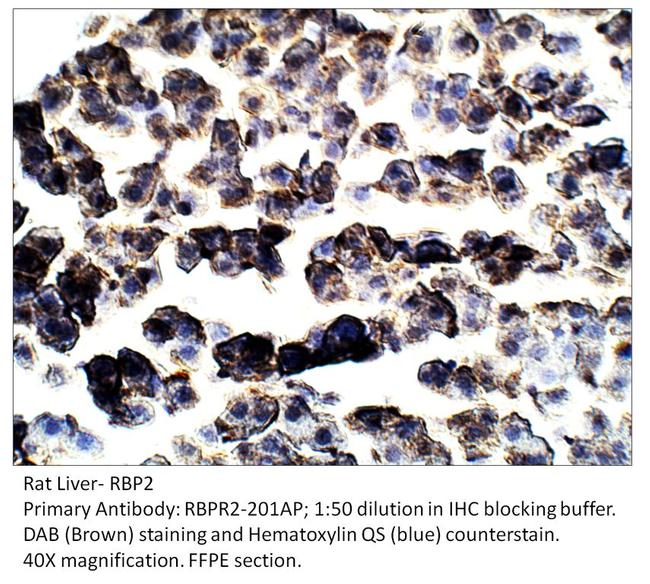 RBP2 Antibody in Immunohistochemistry (IHC)