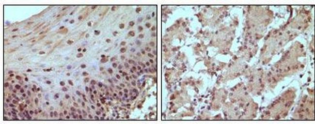 Rb Antibody in Immunohistochemistry (Paraffin) (IHC (P))