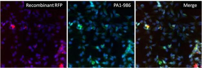 RFP Antibody in Immunocytochemistry (ICC/IF)