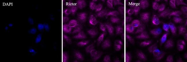 RICTOR Antibody in Immunocytochemistry (ICC/IF)