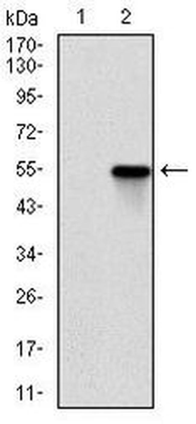 ROCK1 Antibody in Western Blot (WB)