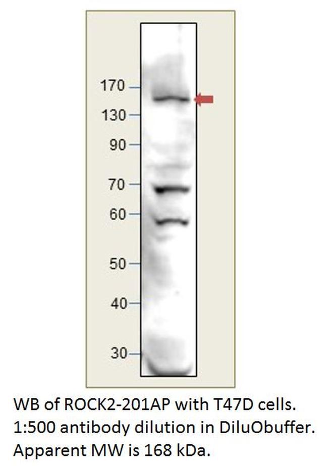 ROCK2 Antibody in Western Blot (WB)