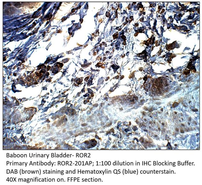 ROR2 Antibody in Immunohistochemistry (IHC)