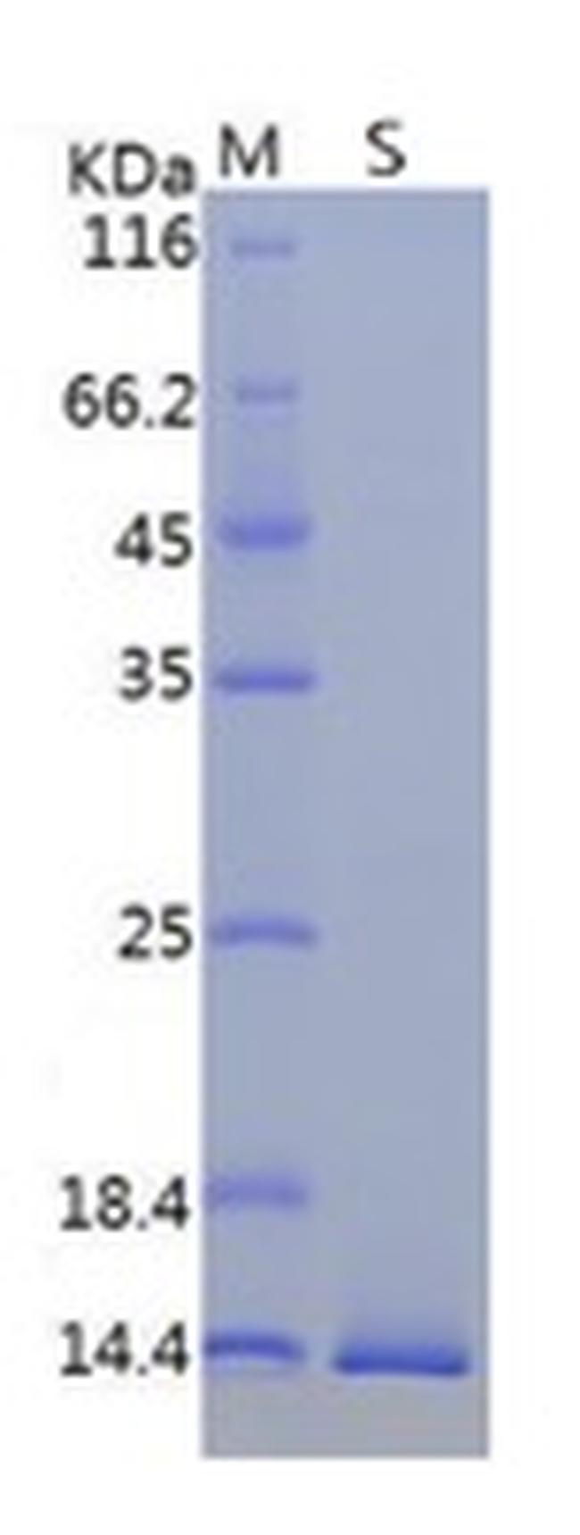 SARS-CoV-2 ORF8 (aa16-121), His Tag Protein