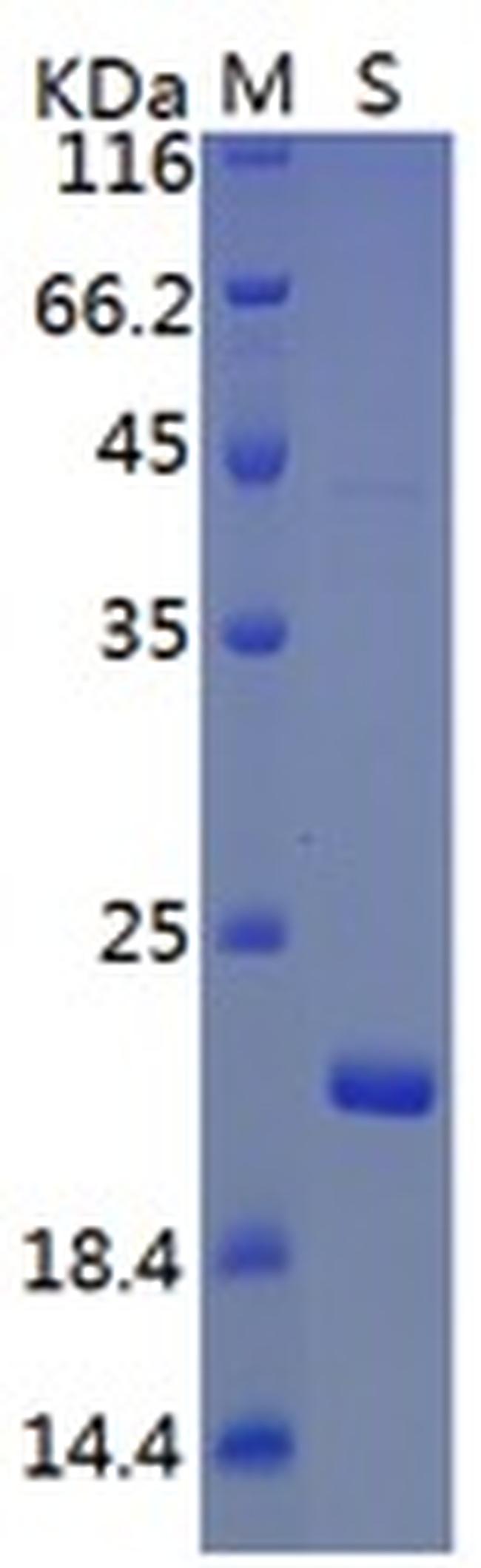 SARS-CoV-2 ORF3a (aa126-275), His Tag Protein