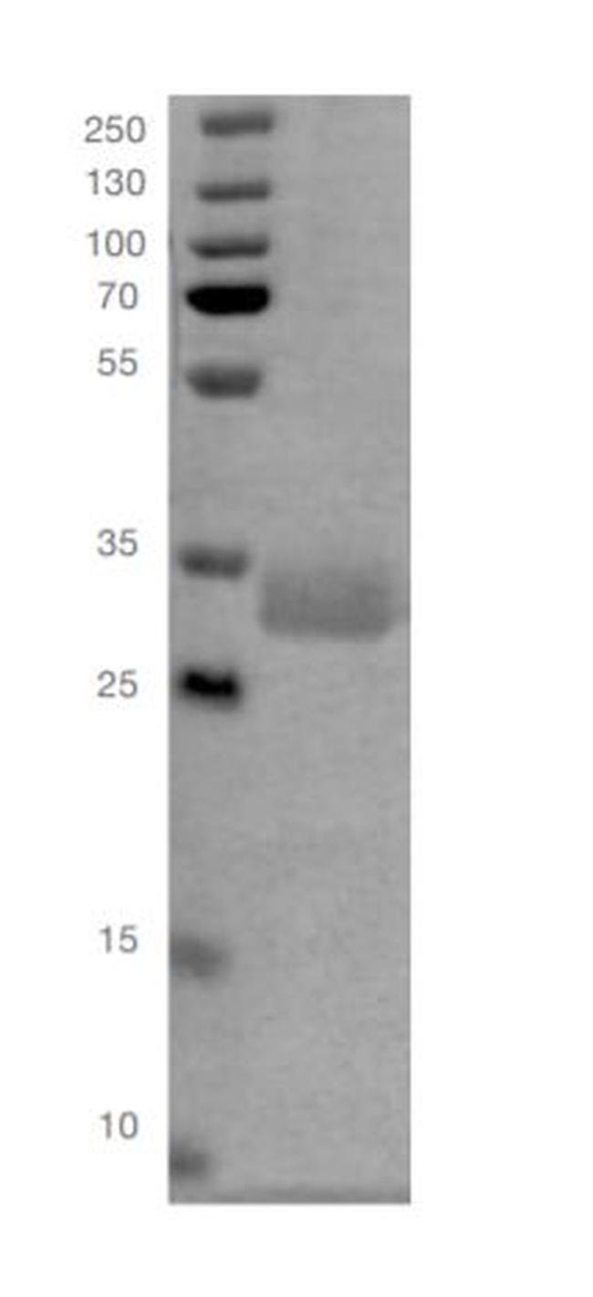 SARS-CoV-2 Spike Protein (RBD) (aa330-524), His Tag Protein