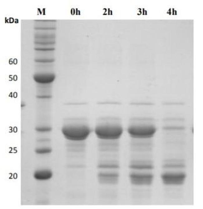 Human HTRA1 Protein