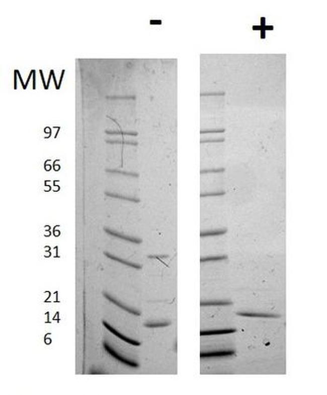 Human IL-16 Protein