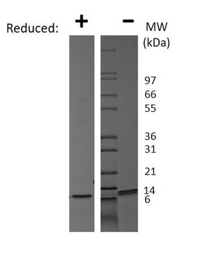 Human CXCL10 (IP-10) Protein