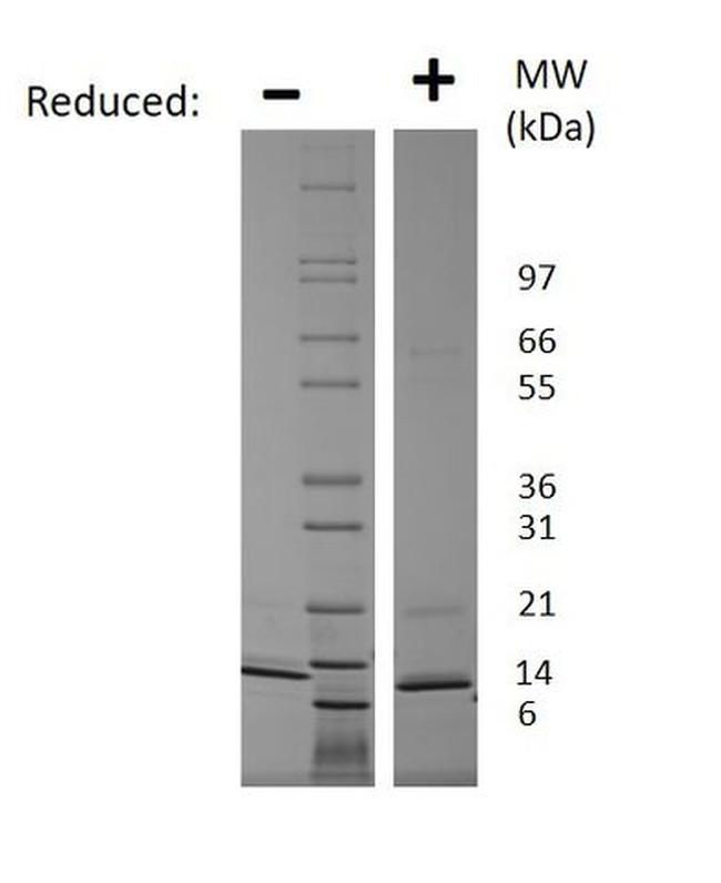 Human CCL7 (MCP-3) Protein