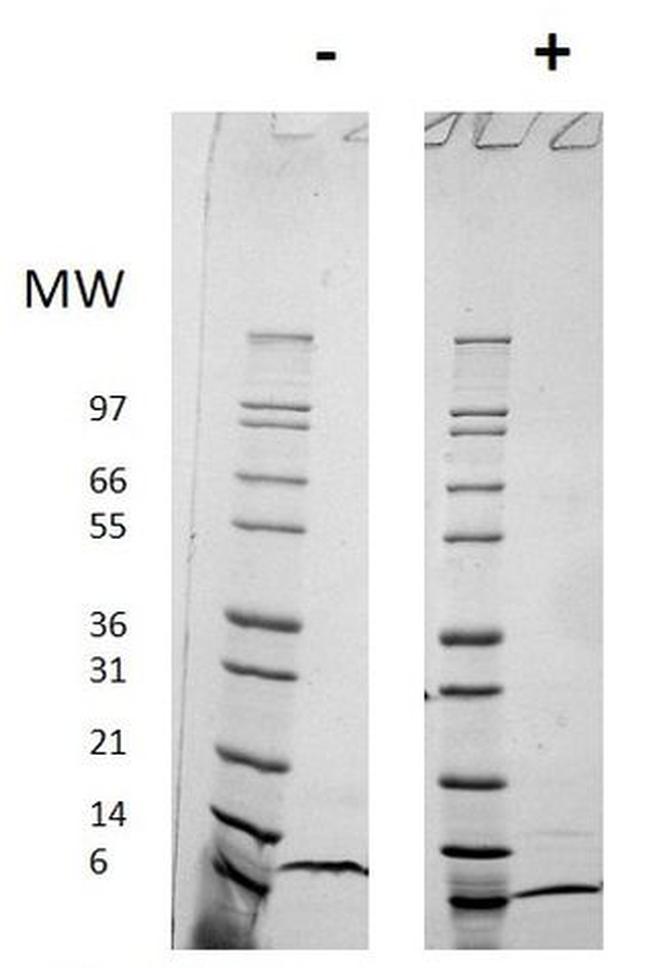 Human CCL18 (MIP-4) Protein