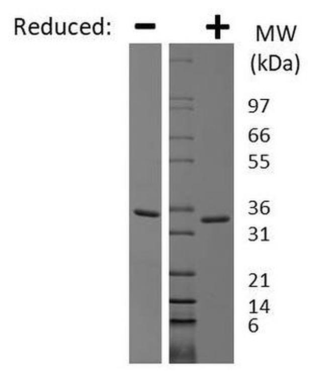 Human Myostatin Propeptide Protein