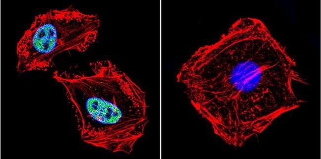 RPA2 Antibody in Immunocytochemistry (ICC/IF)