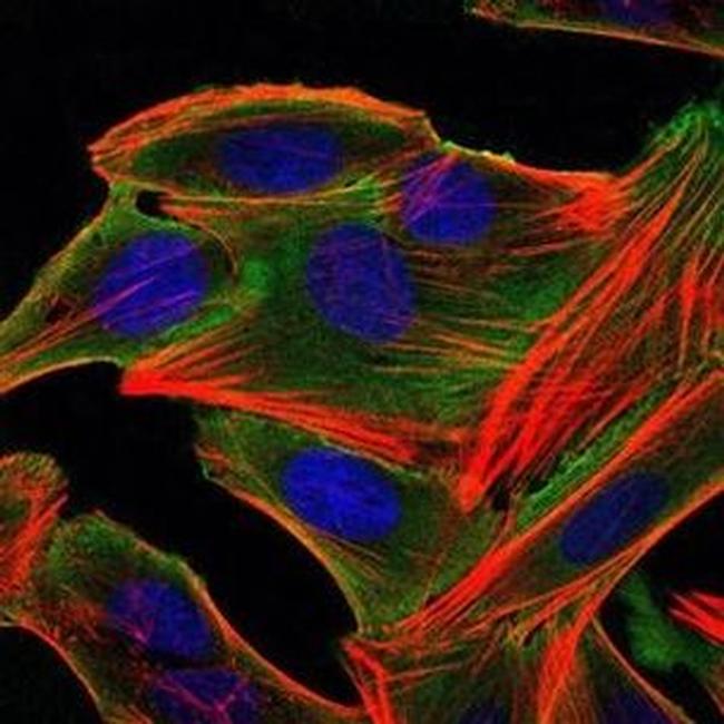 RSK2 Antibody in Immunocytochemistry (ICC/IF)