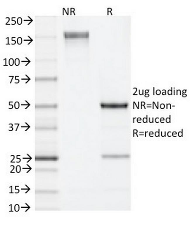 IL-4 (Interleukin-4) Antibody in SDS-PAGE (SDS-PAGE)