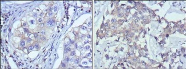 RTN3 Antibody in Immunohistochemistry (Paraffin) (IHC (P))