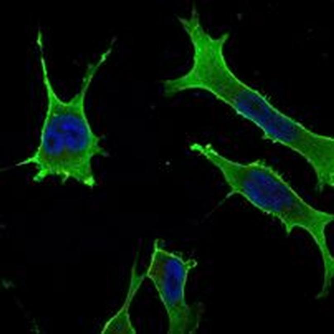 RAB10 Antibody in Immunocytochemistry (ICC/IF)