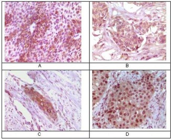 RAB25 Antibody in Immunohistochemistry (Paraffin) (IHC (P))