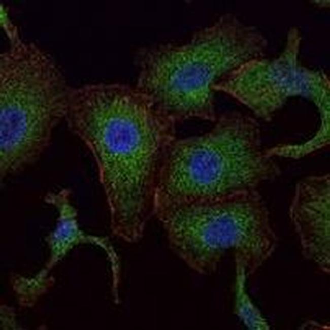 RAB25 Antibody in Immunocytochemistry (ICC/IF)