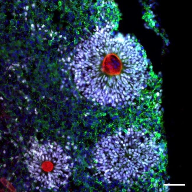 Rabbit IgG (H+L) Highly Cross-Adsorbed Secondary Antibody in Immunohistochemistry (Frozen) (IHC (F))